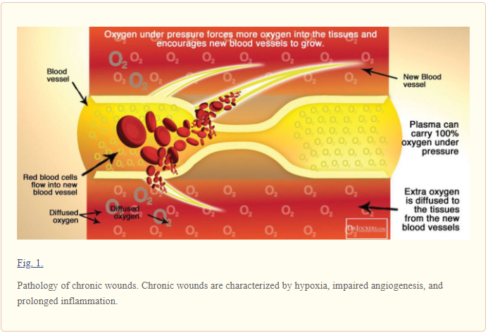 diagram of HBOT healing process